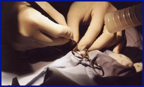 Georgetown Animal Clinic, PC - Veterinarian serving Williamsville, Amherst and Buffalo NY areas: Laser Surgery in action