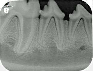 Georgetown Animal Clinic, PC - Veterinarian serving Williamsville, Amherst and Buffalo NY areas: Digital X-Ray of Dog Teeth