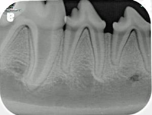 Georgetown Animal Clinic, PC - Veterinarian serving Williamsville, Amherst and Buffalo NY areas: Digital x-ray of dog teeth Georgetown Animal Clinic, PC - Veterinarian serving Williamsville, Amherst and Buffalo NY areas: Digital x-ray of dog teeth