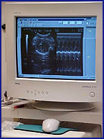 Ultrasound Machine